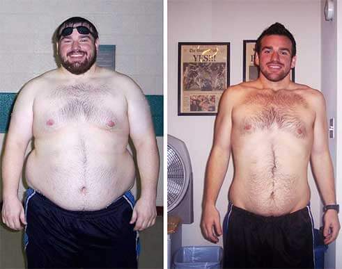 Before/After Photo
