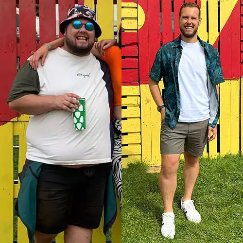 Before/After Photo